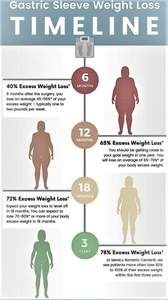 Gastric Sleeve Surgery Weight-Loss Timeline