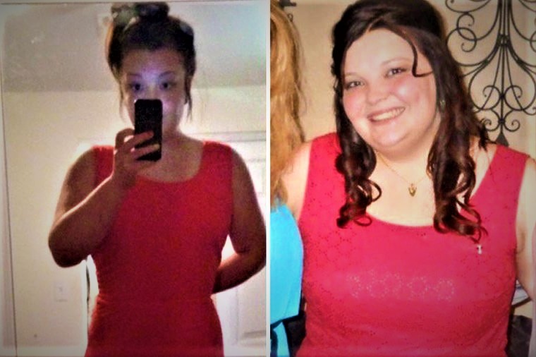 before and after weightloss pictures